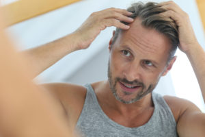 Erblich-bedingter Haarausfall bei Männern