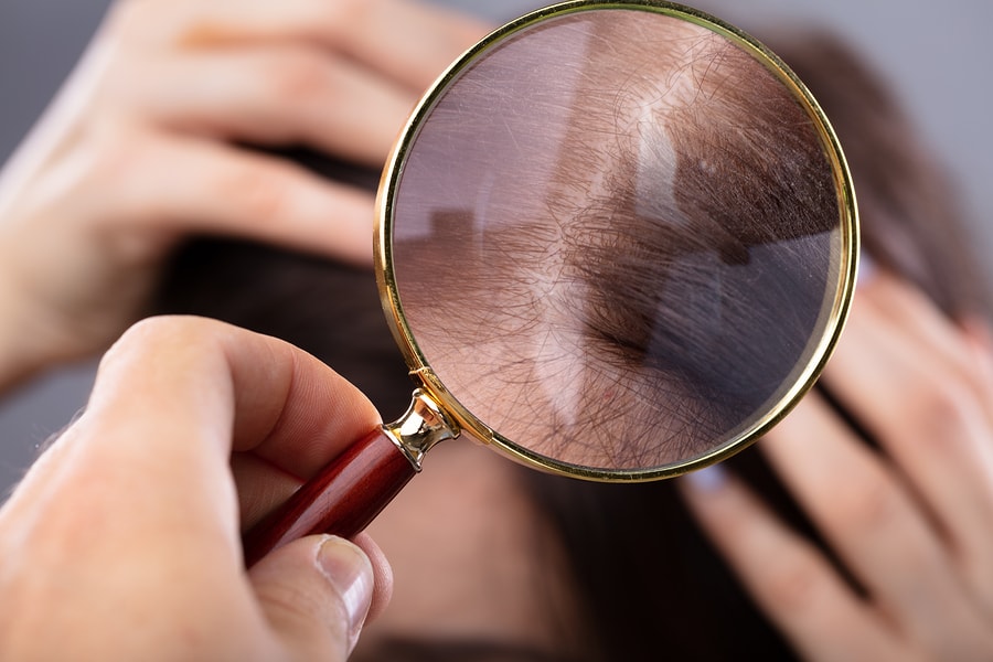 Dermatologist prüft die Haare einer Frau Dermatologist prüft Haare einer Frau mit Haarausfall
