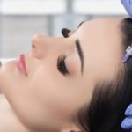 PRP-Behandlung gegen Haarausfall