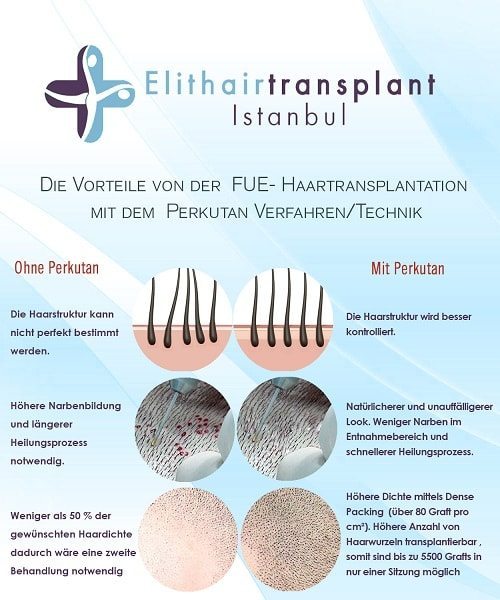 Perkutan Technik Haartransplantation