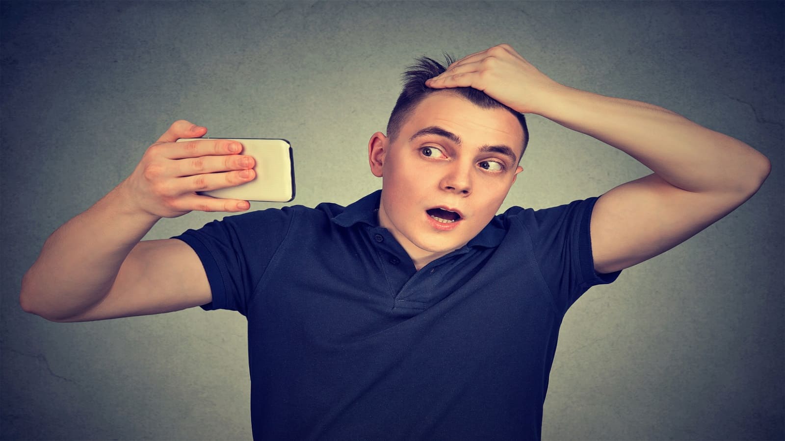 Männer und Haarausfall