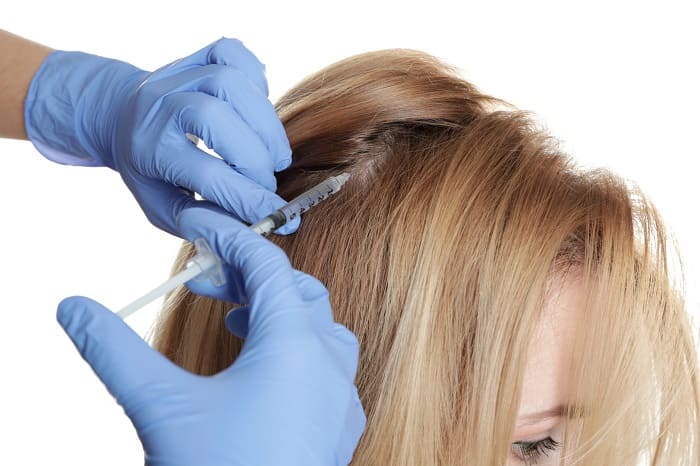 Ablauf einer Mesotherapie gegen Haarausfall