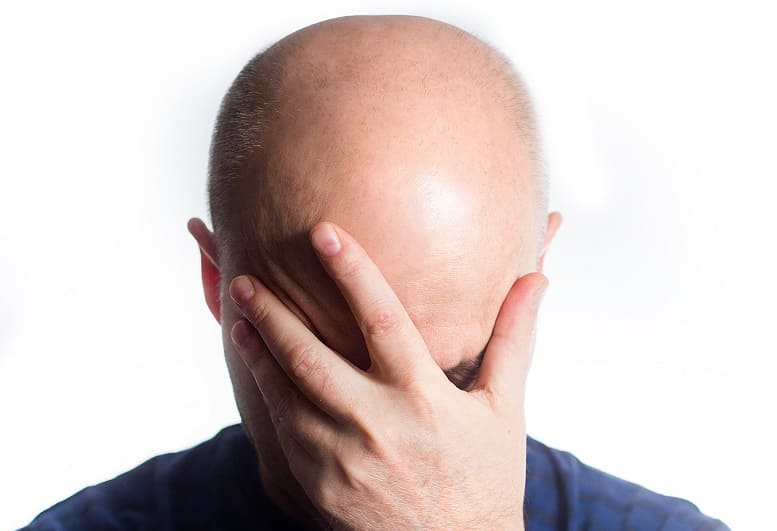 Jahreszeitbedingte Glatzenbildung bei Männer jahreszeitbedingte Glatzenbildung was tun Haarausfall in Sommer