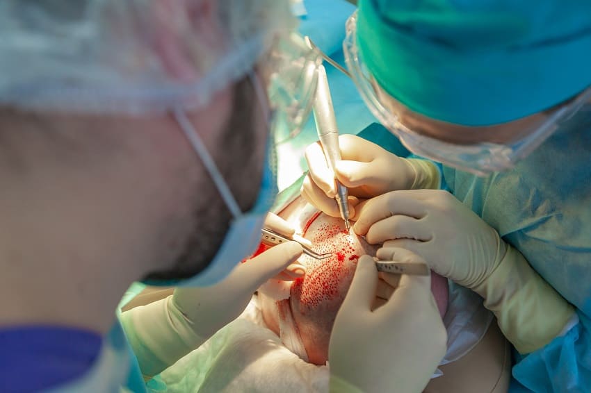 2 Ärzte nehmen eine Haartransplantation vor