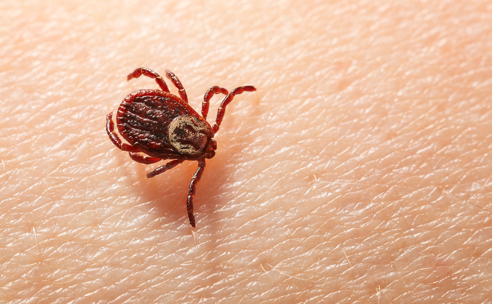 Haarausfall bei Borreliose