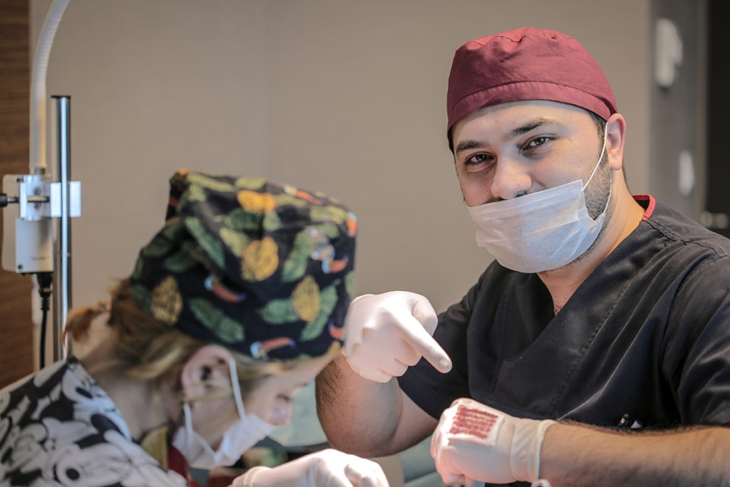 Dr. Balwi entnimmt die richtige Anzahl an Grafts bei der Haartransplantation in der Türkei für ein perfektes Vorher Nachher Ergebnis.