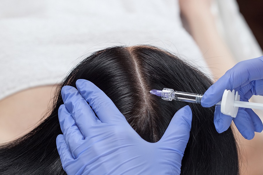 Durch die Haarverdichtung mit Eigenbluttherapie voluminöses Haar erhalten