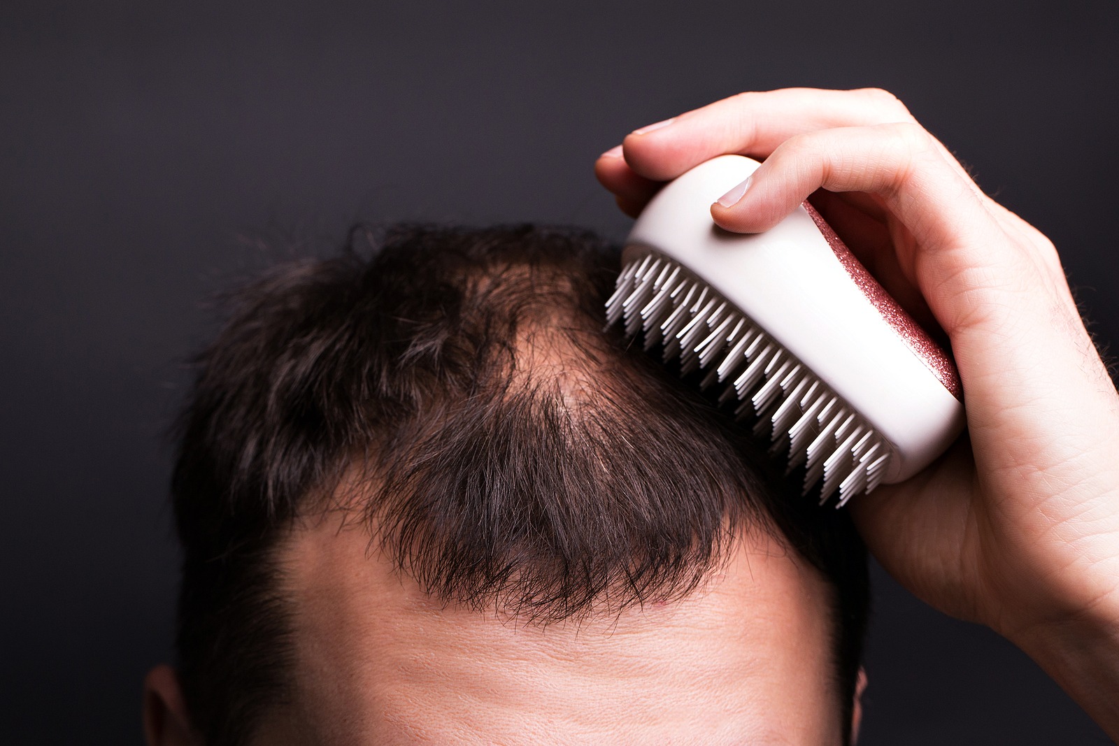 Großflächiger Haarausfall