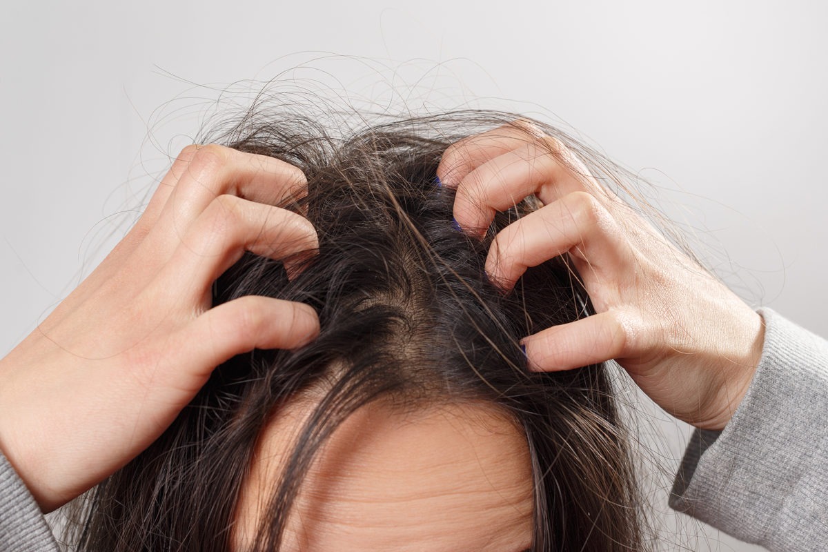 Haarausfall durch trockene Kopfhaut Was ist daran wahr